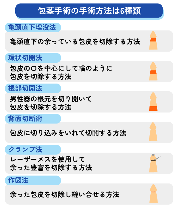 包茎手術の方法は6種類