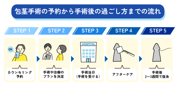 包茎手術の予約から手術後までの流れ